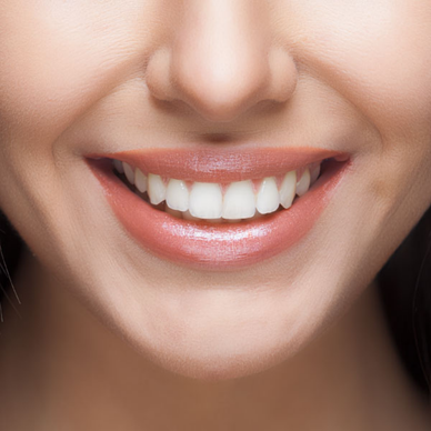 Strahlendes Lächeln, neues Selbstbewusstsein!